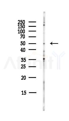 Spastin Antibody - Western blot analysis of lysates from EC304 cells(LPS,4h treatment), using Spastin Antibody at 1/1000 dilution.