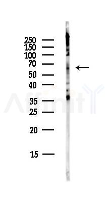 Spastin Antibody - Western blot analysis of lysates from COLO205 cells(heat-shock,45min treatment), using Spastin Antibody at 1/1000 dilution.