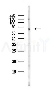Transketolase Antibody - Western blot analysis of lysates from EC304 cells(heat-shock,45min treatment), using Transketolase Antibody at 1/1000 dilution.