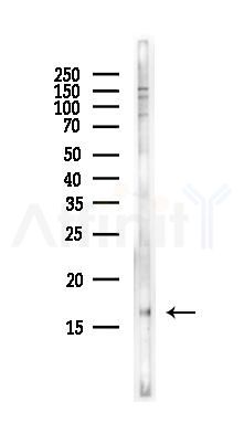PDE6 delta Antibody - Western blot analysis of lysates from EC304 cells(heat-shock,45min treatment), using PDE6 delta Antibody at 1/1000 dilution.