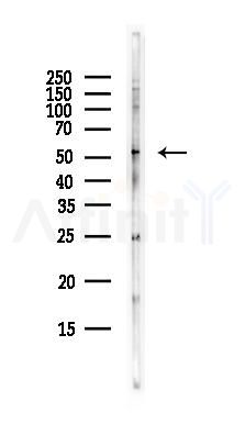 BACE2 Antibody - Western blot analysis of lysates from EC304 cells(heat-shock,45min treatment), using BACE2 Antibody at 1/1000 dilution.