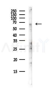 RFX5 Antibody - Western blot analysis of lysates from B16F10-LUC cells(starvation,24h treatment), using RFX5 Antibody at 1/1000 dilution.