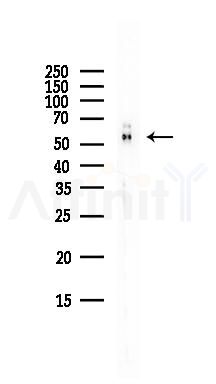 CSN1 Antibody - Western blot analysis of lysates from EC304 cells(heat-shock,45min treatment), using CSN1 Antibody at 1/1000 dilution.