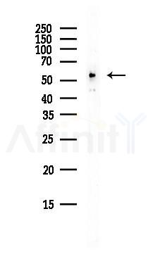 CSN1 Antibody - Western blot analysis of lysates from B16F10-LUC cells(starvation,24h treatment), using CSN1 Antibody at 1/1000 dilution.