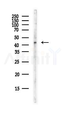 Pellino 1 Antibody - Western blot analysis of lysates from B16F10-LUC cells(starvation,24h treatment), using Pellino 1 Antibody at 1/1000 dilution.