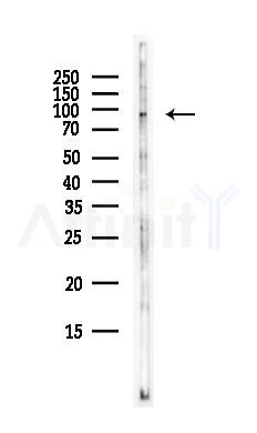 TLR10 Antibody - Western blot analysis of lysates from EC304 cells(heat-shock,45min treatment), using TLR10 Antibody at 1/1000 dilution.