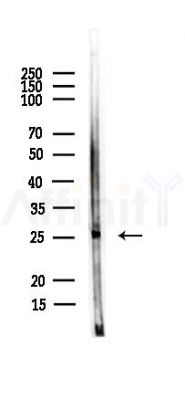 BarX1 Antibody - Western blot analysis of lysates from Rat lung, using BarX1 Antibody at 1/1000 dilution.