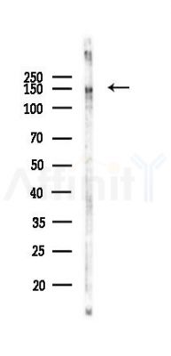 SUPT5H Antibody - Western blot analysis of lysates from Mouse liver, using SUPT5H Antibody at 1/1000 dilution.