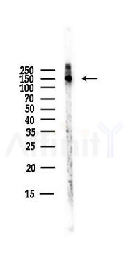 SUPT5H Antibody - Western blot analysis of lysates from B16F10-LUC cells(starvation,24h treatment), using SUPT5H Antibody at 1/1000 dilution.