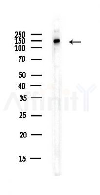 SUPT5H Antibody - Western blot analysis of lysates from EC304 cells(heat-shock,45min treatment), using SUPT5H Antibody at 1/1000 dilution.