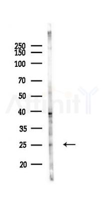 TFIIF Antibody - Western blot analysis of lysates from Mouse liver, using TFIIF Antibody at 1/1000 dilution.