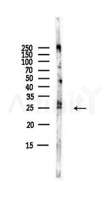 TFIIF Antibody - Western blot analysis of lysates from B16F10-LUC cells(starvation,24h treatment), using TFIIF Antibody at 1/1000 dilution.