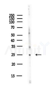 TFIIF Antibody - Western blot analysis of lysates from EC304 cells(heat-shock,45min treatment), using TFIIF Antibody at 1/1000 dilution.