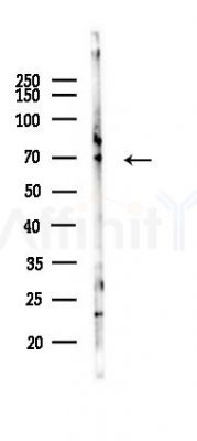 Calpain 5 Antibody - Western blot analysis of lysates from Mouse liver, using Calpain 5 Antibody at 1/1000 dilution.