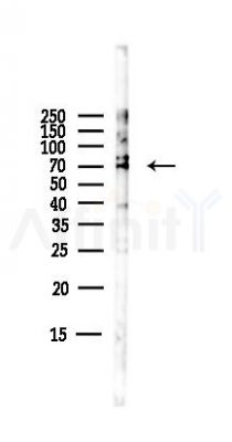 Calpain 5 Antibody - Western blot analysis of lysates from B16F10-LUC cells(starvation,24h treatment), using Calpain 5 Antibody at 1/1000 dilution.
