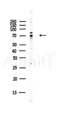 Calpain 5 Antibody - Western blot analysis of lysates from EC304 cells(heat-shock,45min treatment), using Calpain 5 Antibody at 1/1000 dilution.