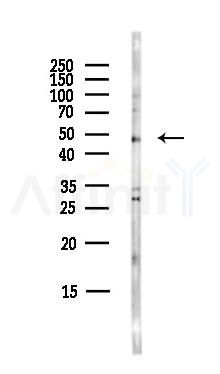 RNF135 Antibody - Western blot analysis of lysates from COLO205 cells(heat-shock,45min treatment), using RNF135 Antibody at 1/1000 dilution.