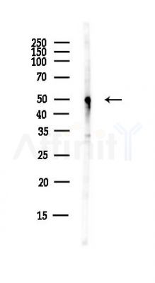 Kv1.8 Antibody - Western blot analysis of lysates from EC304 cells(heat-shock,45min treatment), using Kv1.