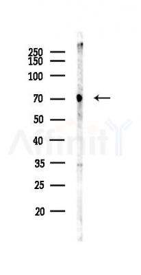ABCE1 Antibody - Western blot analysis of lysates from Mouse liver, using ABCE1 Antibody at 1/1000 dilution.