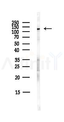 NALP2 Antibody - Western blot analysis of lysates from COLO205 cells(heat-shock,45min treatment), using NALP2 Antibody at 1/1000 dilution.