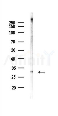 U1A Antibody - Western blot analysis of lysates from Mouse liver, using U1A Antibody at 1/1000 dilution.