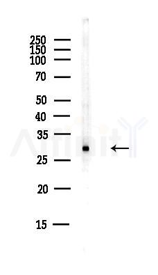 U1A Antibody - Western blot analysis of lysates from EC304 cells(heat-shock,45min treatment), using U1A Antibody at 1/1000 dilution.