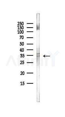 Hex Antibody - Western blot analysis of lysates from HepG2 cells(LPS, 4h treatment), using Hex Antibody at 1/1000 dilution.