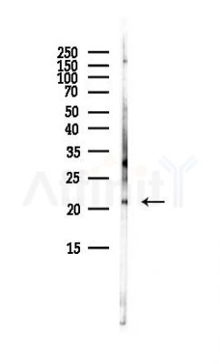REG1 alpha Antibody - Western blot analysis of lysates from PC12 cells(starvation, 24h treatment), using REG1 alpha Antibody at 1/1000 dilution.