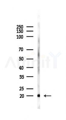 REG1 alpha Antibody - Western blot analysis of lysates from Rat testis, using REG1 alpha Antibody at 1/1000 dilution.