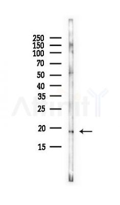 REG1 alpha Antibody - Western blot analysis of lysates from HepG2 cells(LPS, 4h treatment), using REG1 alpha Antibody at 1/1000 dilution.
