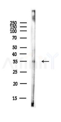 CCNO Antibody - Western blot analysis of lysates from EC304 cells(heat-shock,45min treatment), using CCNO Antibody at 1/1000 dilution.