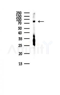 SEC23 Antibody - Western blot analysis of lysates from PC12 cells(starvation, 24h treatment), using SEC23 Antibody at 1/1000 dilution.