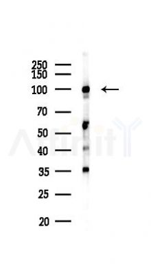 Matrin 3 Antibody - Western blot analysis of lysates from Mouse liver, using Matrin 3 Antibody at 1/1000 dilution.