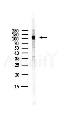 Matrin 3 Antibody - Western blot analysis of lysates from B16F10-LUC cells(starvation,24h treatment), using Matrin 3 Antibody at 1/1000 dilution.