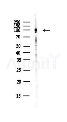 Matrin 3 Antibody - Western blot analysis of lysates from EC304 cells(heat-shock,45min treatment), using Matrin 3 Antibody at 1/1000 dilution.