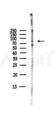 PARP9 Antibody - Western blot analysis of lysates from B16F10-LUC cells(starvation,24h treatment), using PARP9 Antibody at 1/1000 dilution.