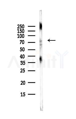 ZNF274 Antibody - Western blot analysis of lysates from HepG2 cells(LPS, 4h treatment), using ZNF274 Antibody at 1/1000 dilution.