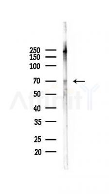 ZNF274 Antibody - Western blot analysis of lysates from Mouse lung, using ZNF274 Antibody at 1/1000 dilution.