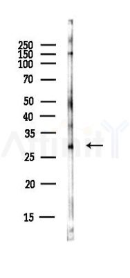 METRN Antibody - Western blot analysis of lysates from EC304 cells(heat-shock,45min treatment), using METRN Antibody at 1/1000 dilution.