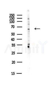 SLC38A4 Antibody - Western blot analysis of lysates from EC304 cells(heat-shock,45min treatment), using SLC38A4 Antibody at 1/1000 dilution.