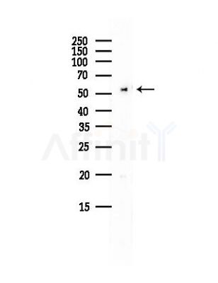 Chimaerin 2 Antibody - Western blot analysis of lysates from Hela cells(UV, 30min treatment), using Chimaerin 2 Antibody at 1/1000 dilution.