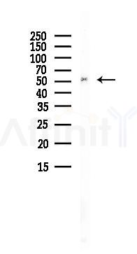 Chimaerin 2 Antibody - Western blot analysis of lysates from A375 cells(heat-shock, 45min treatment), using Chimaerin 2 Antibody at 1/1000 dilution.