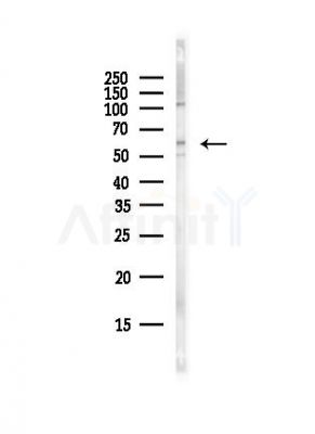 NRAMP1 Antibody - Western blot analysis of lysates from Hela cells(UV, 30min treatment), using NRAMP1 Antibody at 1/1000 dilution.