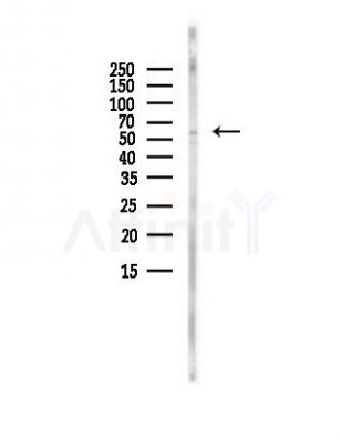 NRAMP1 Antibody - Western blot analysis of lysates from A375 cells(heat-shock, 45min treatment), using NRAMP1 Antibody at 1/1000 dilution.