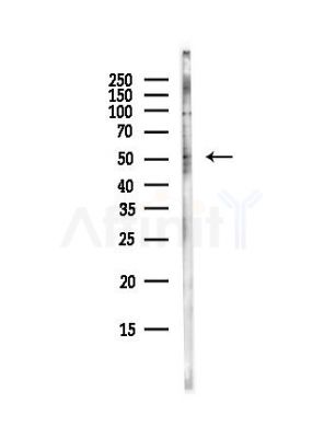 PPM1M Antibody - Western blot analysis of lysates from Hela cells(UV, 30min treatment), using PPM1M Antibody at 1/1000 dilution.
