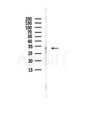 SLC35B1 Antibody - Western blot analysis of lysates from A375 cells(heat-shock, 45min treatment), using SLC35B1 Antibody at 1/1000 dilution.