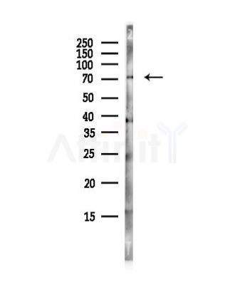 SLC5A4 Antibody - Western blot analysis of lysates from Hela cells(UV, 30min treatment), using SLC5A4 Antibody at 1/1000 dilution.