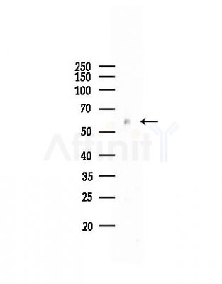 ALDH6A1 Antibody - Western blot analysis of lysates from Mouse liver, using ALDH6A1 Antibody at 1/1000 dilution.
