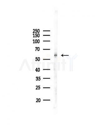 CHRNA6 Antibody - Western blot analysis of lysates from Mouse liver, using CHRNA6 Antibody at 1/1000 dilution.