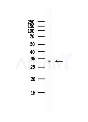 DCYTB Antibody - Western blot analysis of lysates from Hela cells(UV, 30min treatment), using Cytochrome b reductase 1 Antibody at 1/1000 dilution.